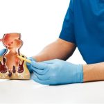 علاج البواسير في دبي: أفضل العلاجات المتاحة وكيفية الحصول على الراحة 4 علاج البواسير في دبي
