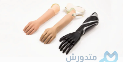 متى يتم تركيب الطرف الصناعي بعد البتر مباشرة